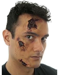 Protesi in lattice ferite profonde